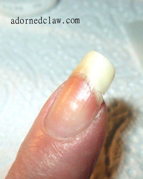 Fixing a broken nail